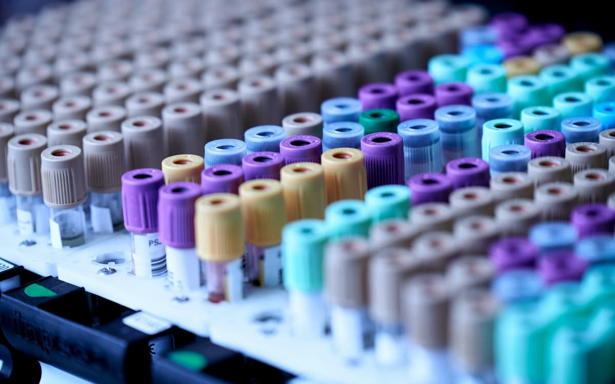 Tubes de prélèvement sanguin alignés dans un portoir de laboratoire